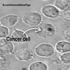 Khasiat daun salam diketahui mampu melawan perkembangan sel kanser?