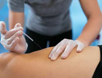 Terapi akupunktur boleh membantu mengurangkan masalah usus bengkak 